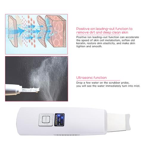 Ultrasonic Skin Scrubber Face Cleanser Blackhead Acne Removal Facial Spa Vibration Massager Ultrasound Peeling Clean Machine 394 - Maison Elène