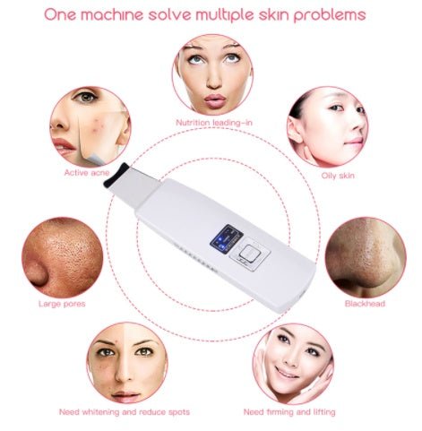 Ultrasonic Skin Scrubber Face Cleanser Blackhead Acne Removal Facial Spa Vibration Massager Ultrasound Peeling Clean Machine 394 - Maison Elène