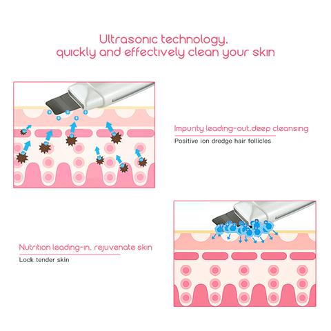 Ultrasonic Skin Scrubber Face Cleanser Blackhead Acne Removal Facial Spa Vibration Massager Ultrasound Peeling Clean Machine 394 - Maison Elène